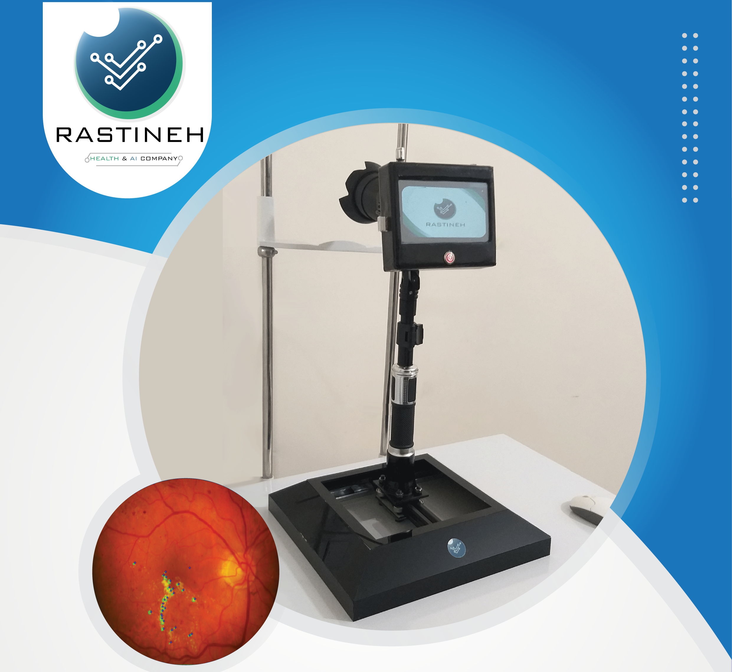 Fundus Camera - 1