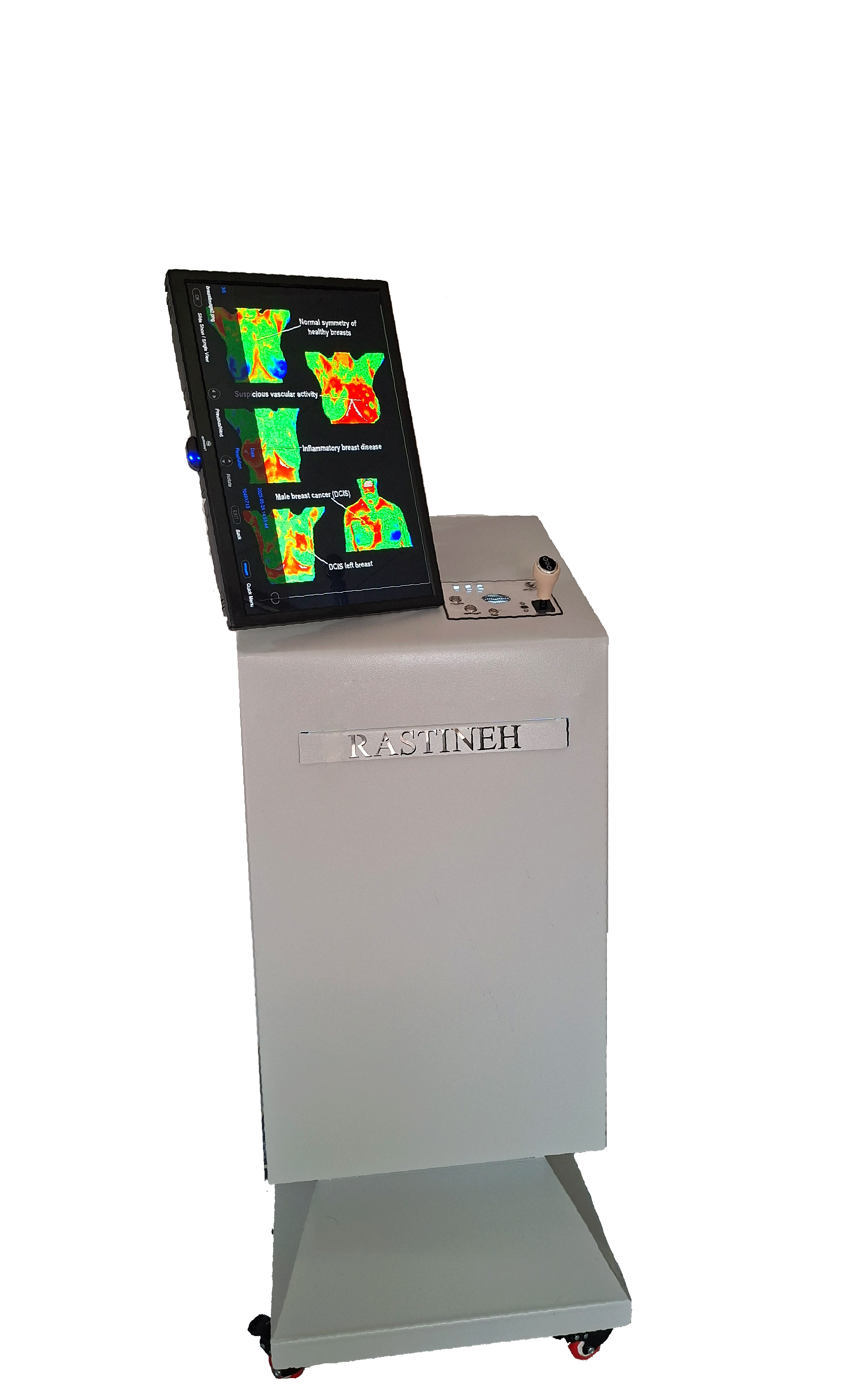 Breast Cancer AI - 1